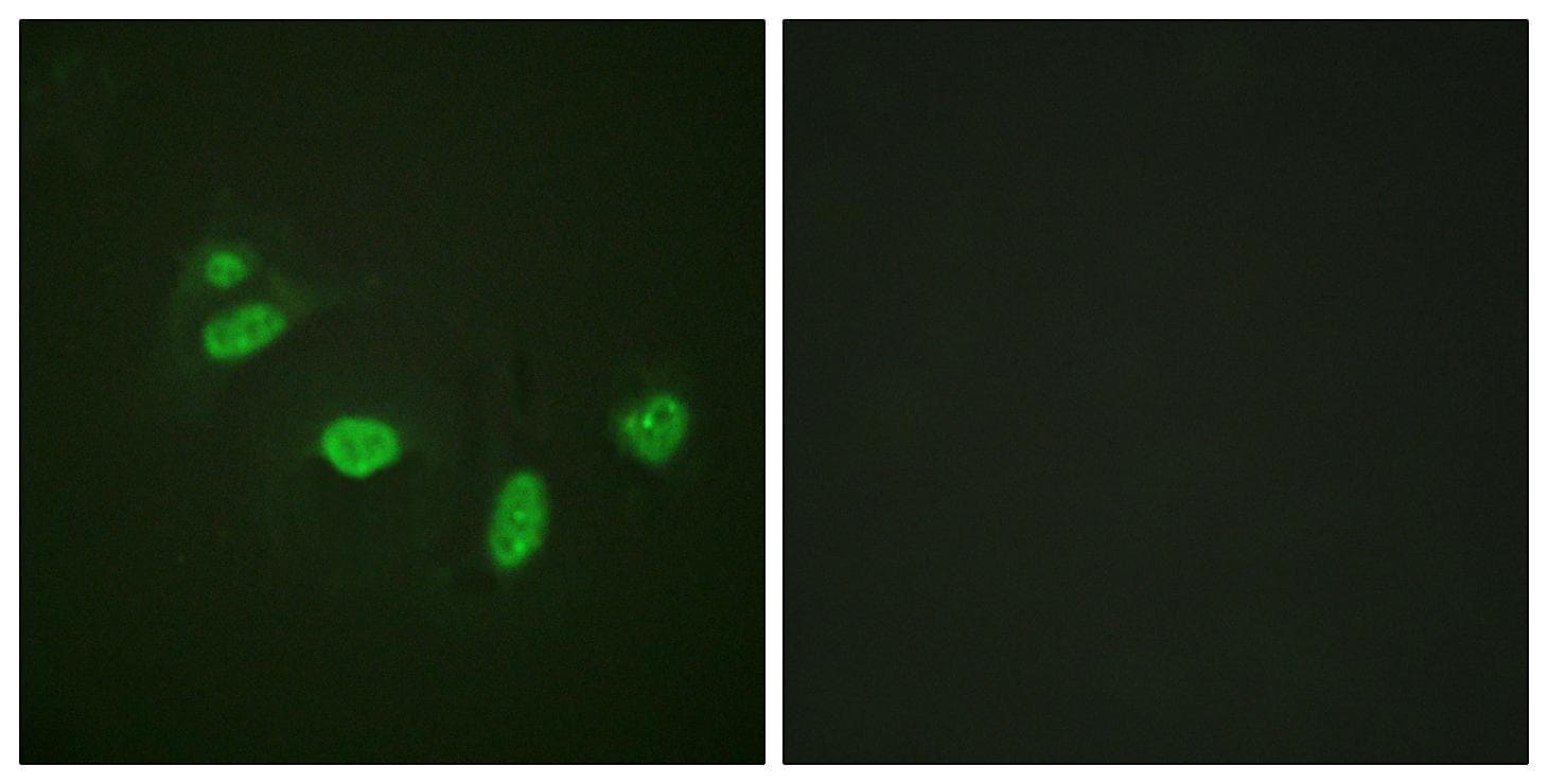 ETS1 / ETS-1 Antibody (phospho-Thr38)