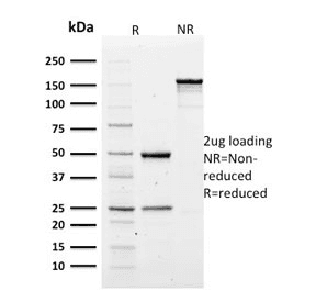 SPTA1 / Alpha Spectrin Antibody (clone SPTA1/1810)