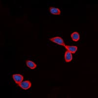 CDH24 / EY Cadherin Antibody (N-Terminus)