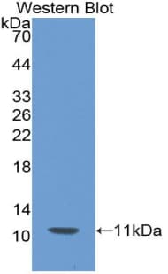 PTH / Parathyroid Hormone Antibody (aa31-115)
