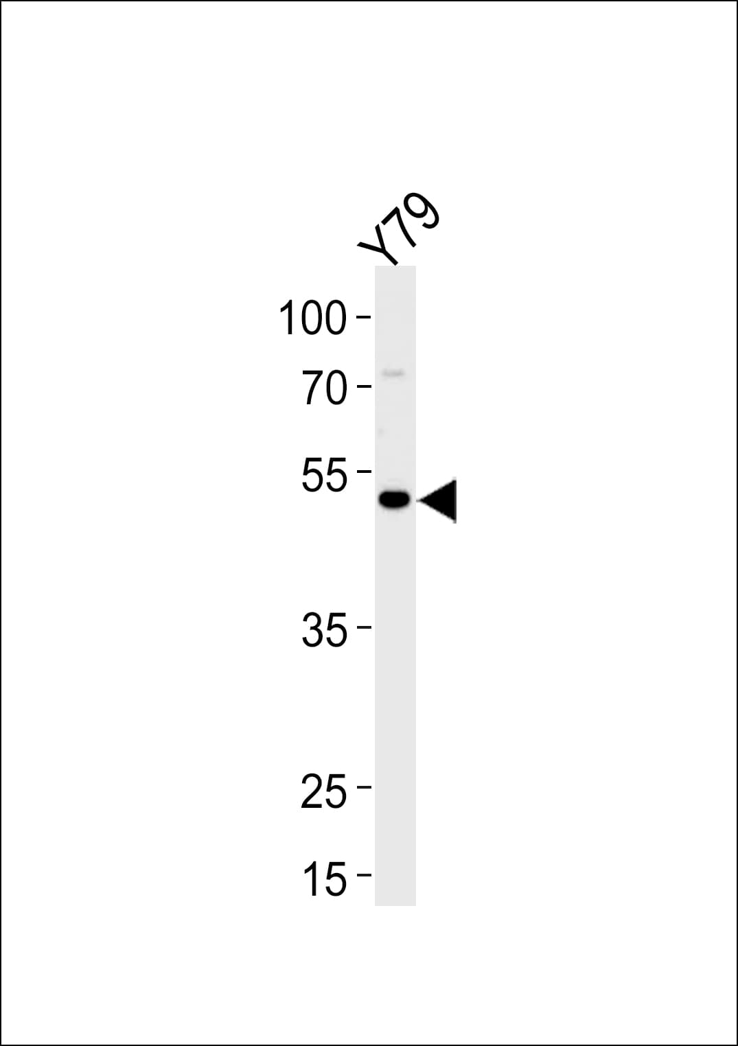 FOXN4 Antibody (aa17-45)