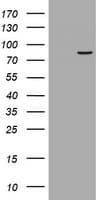 Monoclonal Mouse anti-Human R1 / RRM1 Antibody (clone OTI13E4, WB)