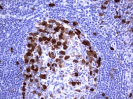 TS / Thymidylate Synthase Antibody (clone OTI5H8, Carrier-free)