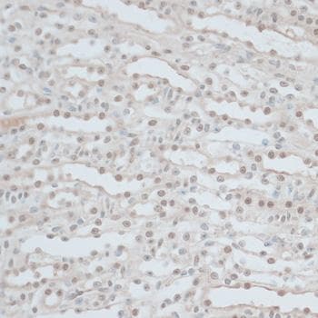 Polyclonal Rabbit anti-Human ZNF562 Antibody (IHC)