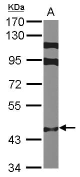 ZNF384 Antibody (N-Terminus)