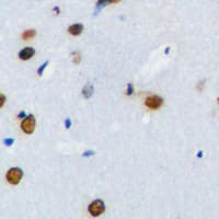 PLK1 / PLK-1 Antibody (Internal)