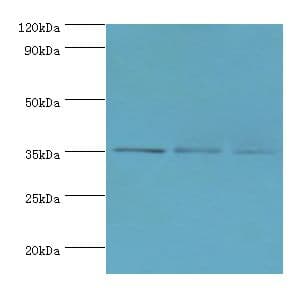 FOSL2 / FRA-2 Antibody (aa187-326)