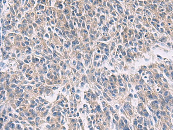 PROKR2/Prokineticin Receptor 2 Antibody