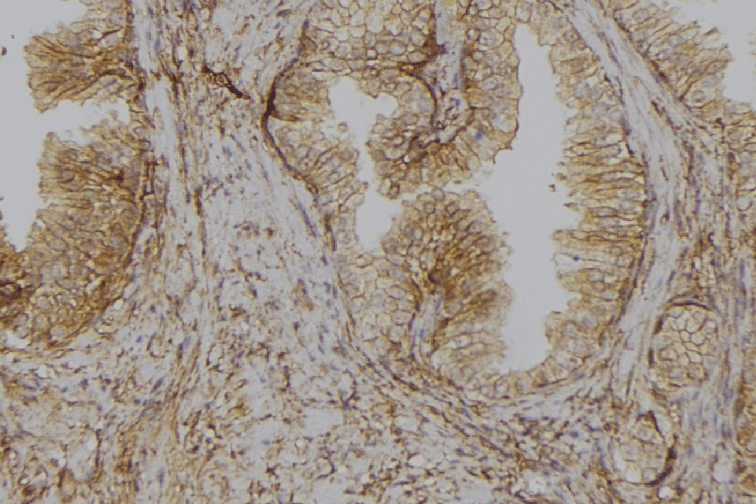 GLYCTK / Glycerate Kinase Antibody