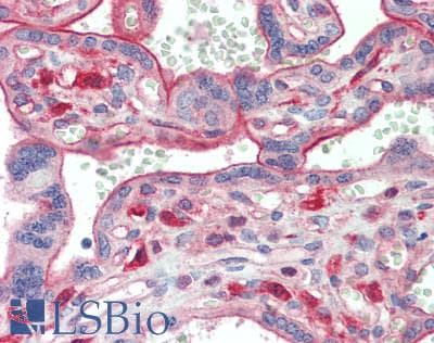 IHC-plus™ Polyclonal Rabbit anti-Human MON1A / SAND1 Antibody (aa205-555, IHC, WB)