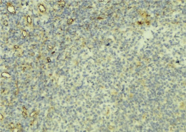 CTLA4 / CD152 Antibody