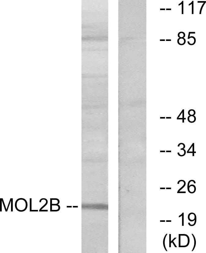 MOBKL2B / MOB3B Antibody (aa71-120)