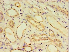 CRD / CRX Antibody (aa120-285)