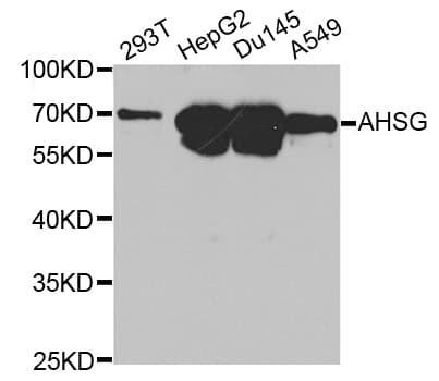 Polyclonal Rabbit anti-Human AHSG / Fetuin A Antibody (IHC, IF, WB)