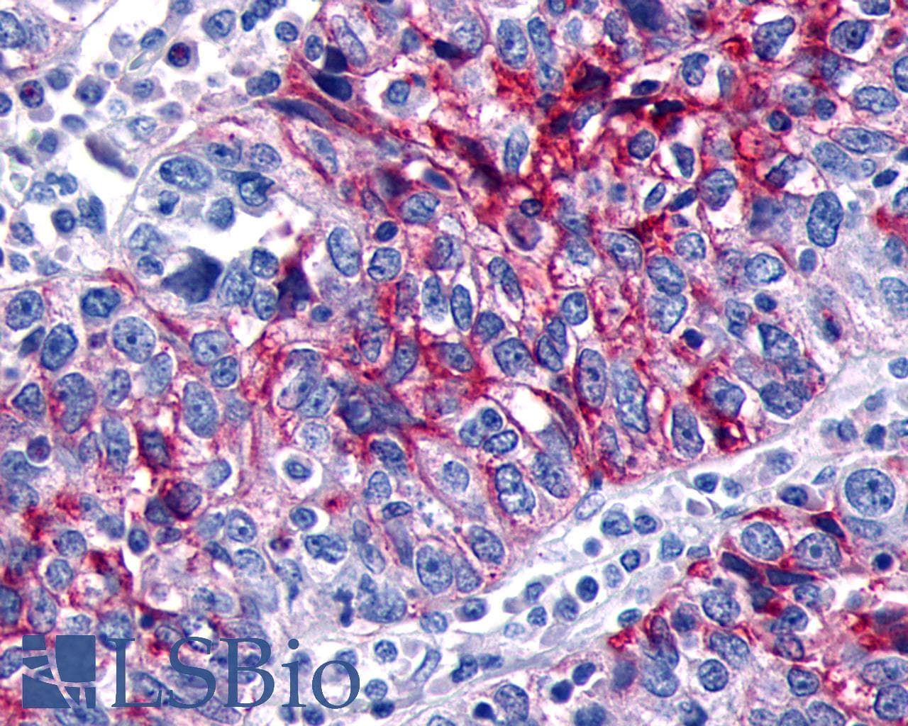 PathPlus™ ADGRD1 / GPR133 Antibody (N-Terminus)