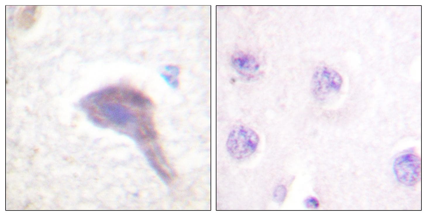 PRKD1 / PKC Mu Antibody (p205)