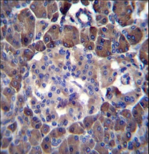 p14ARF / CDKN2A Antibody (aa72-101)