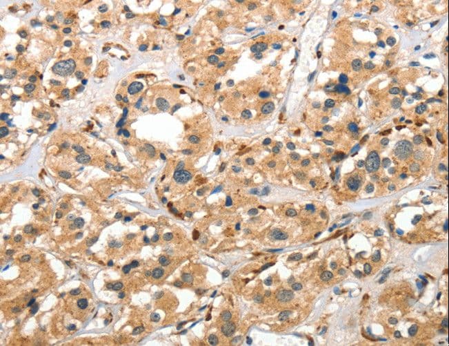 CTSE / Cathepsin E Antibody