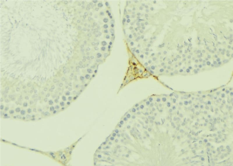 Polyclonal Rabbit anti-Human SPINLW1 / EPPIN Antibody (IHC, IF, WB)