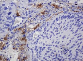 Monoclonal Mouse anti-Human SOAT2 Antibody (clone OTI2E12, aa1-120, IHC)