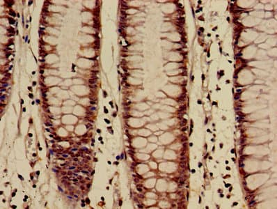 Polyclonal Rabbit anti-Human HIST1H3A Antibody (IHC, IF)