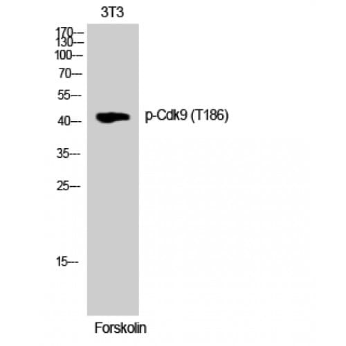 CDK9 Antibody (130-210 aa)