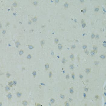 SMAD6 Antibody