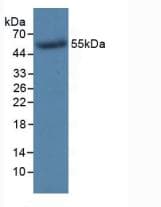 TK1 / TK / Thymidine Kinase Antibody (PE)