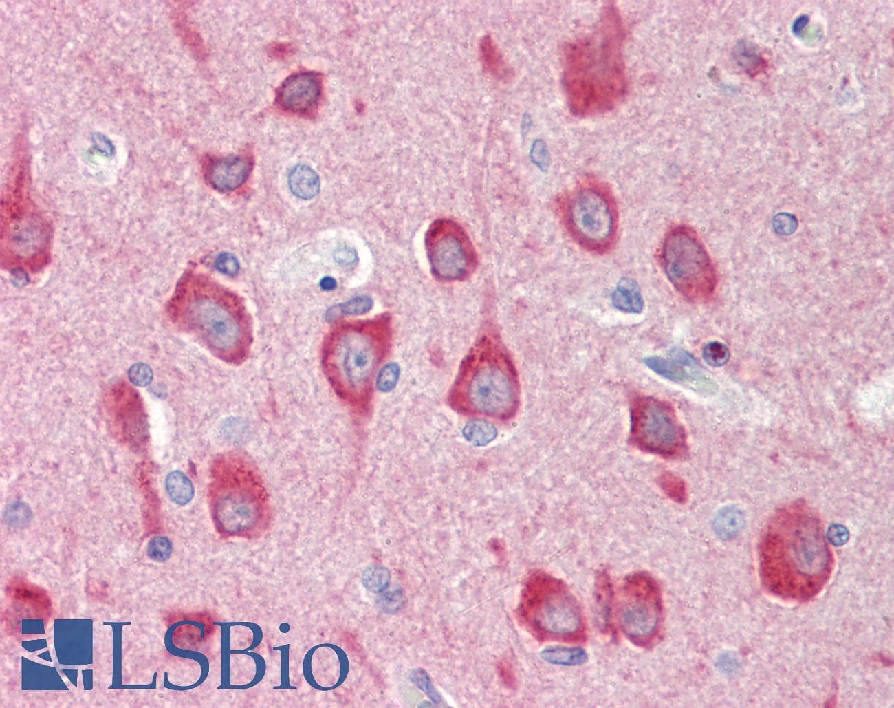 IHC-plus™ Polyclonal Rabbit anti-Human MAP1LC3B / LC3B Antibody (aa100-125, IHC, IF, WB)
