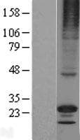 RGS17 / RGSZ2 Protein (Over-Expression Lysate Myc-DDK (Flag))