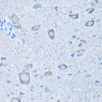 Polyclonal Rabbit anti-Human NNMT Antibody (IHC, IF, WB)