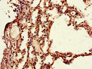Polyclonal Rabbit anti-Human PAIP2 Antibody