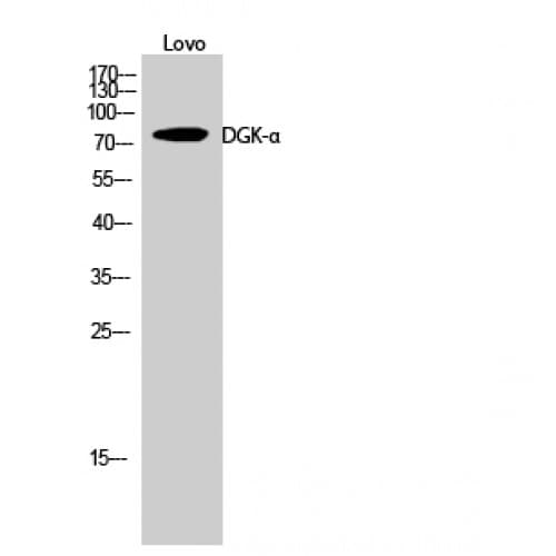 Polyclonal Rabbit anti-Human DGKA Antibody (280-360 aa, Internal, IHC, WB)