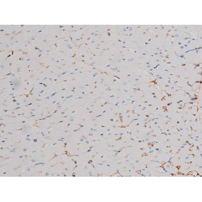 CDC25A Antibody (phospho-Ser178)