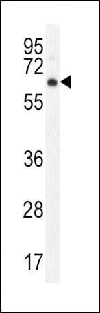AKT1 Antibody (aa428-457)