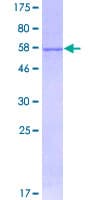 Human HMGCL Protein (Recombinant GST)
