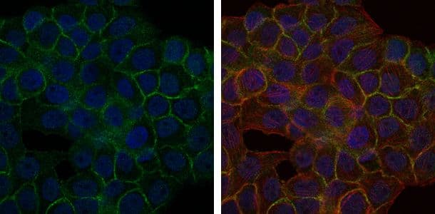 BLNK Antibody (clone 5G9)