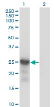 IHC-plus™ Monoclonal Mouse anti-Human CDKN1B / p27 Kip1 Antibody (clone 4B4-E6, IHC, IF, WB)