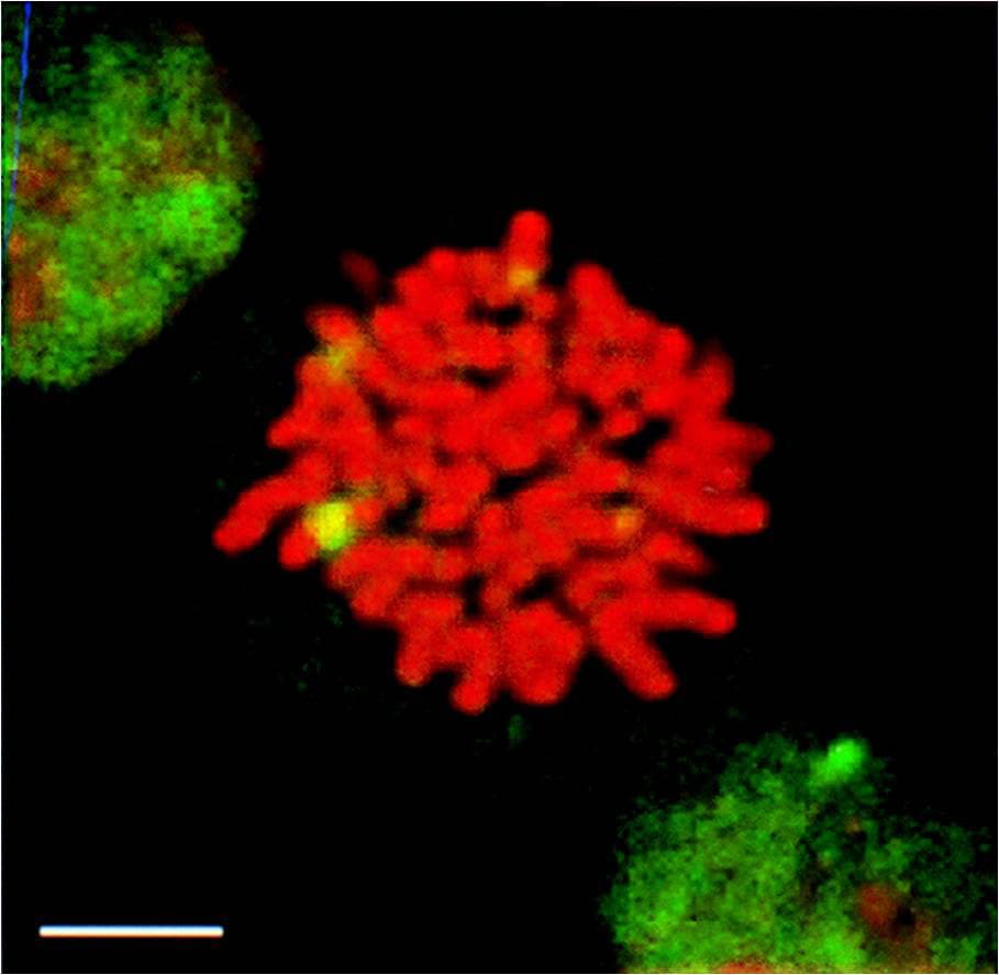 IHC-plus™ HSF1 Antibody (clone 10H8)