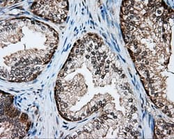 Monoclonal Mouse anti-Human SRR / Serine Racemase Antibody (clone OTI5D10, IHC, WB)