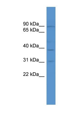 TBC1D26 Antibody (C-Terminus)