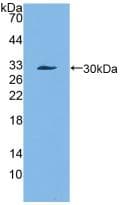 Alpha-1-Antichymotrypsin Antibody