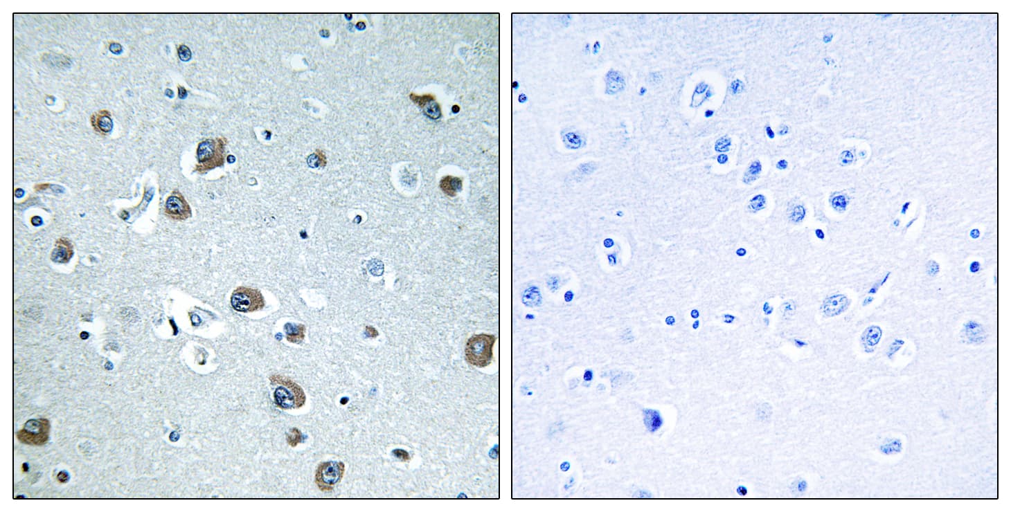GNAL Antibody (aa41-90)