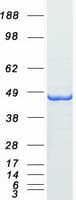 Human AMACR / P504S Protein (Recombinant Myc-DDK (Flag))
