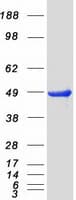 Human PRKAR2B Protein (Recombinant Myc-DDK (Flag))