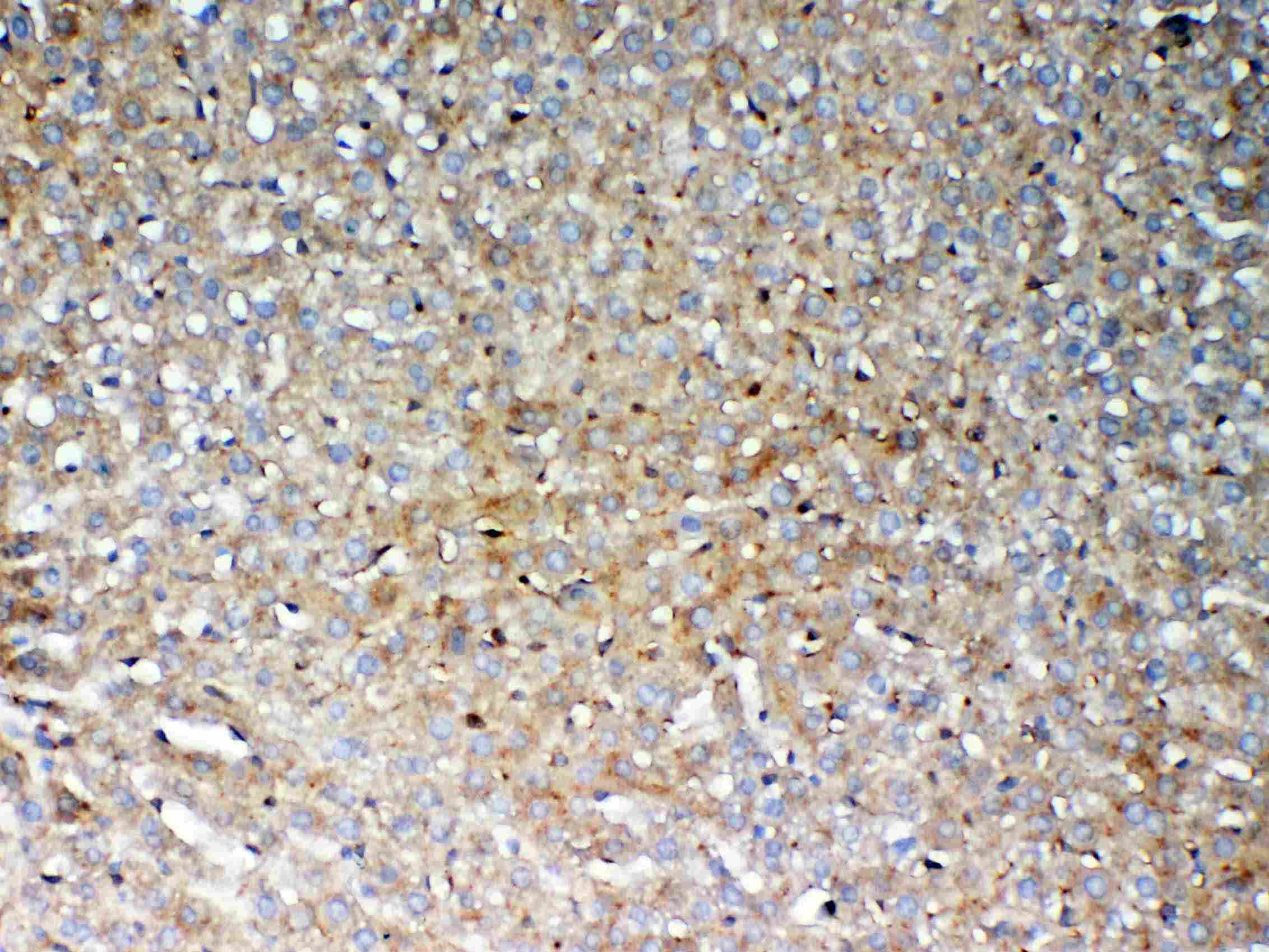 GALNS / Chondroitinase Antibody