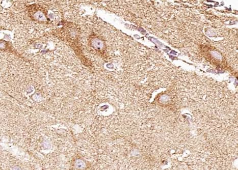Polyclonal Rabbit anti-Human EPHB4 / EPH Receptor B4 Antibody (IHC, WB)