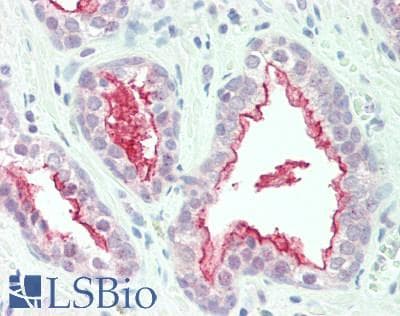 IHC-plus™ Polyclonal Rabbit anti-Human IRS2 / IRS-2 Antibody (aa1100-1150, IHC, WB)