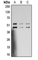 JNK1+2+3 Antibody (phospho-Thr183/Tyr185)