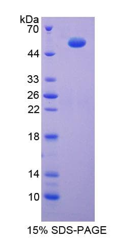 Rat ATP5B / ATP Synthase Beta Protein (Recombinant His-T7)